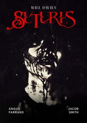 Sutures
