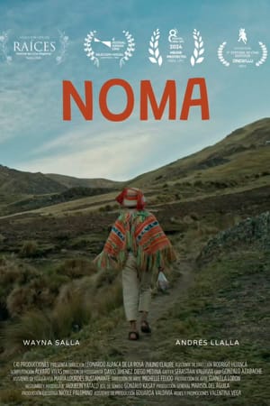 Noma